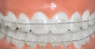 Orthodontist Zurich